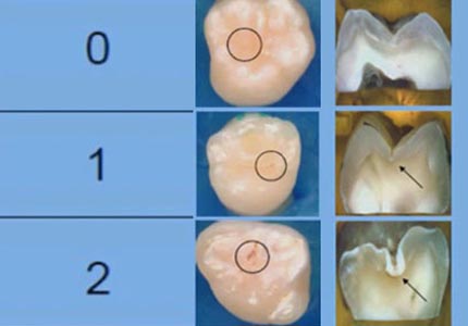 Odontología Minimamente Invasiva 2021 1A