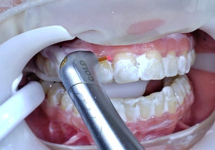 Odontología Láser Inicial 2022 1A