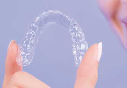 Clear Aligner 2019
