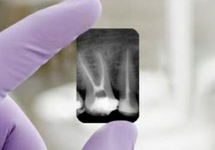 Endodoncia 2025 1A