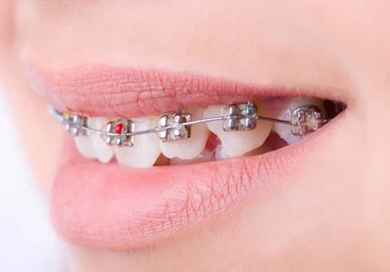 Ortodoncia Inicial 2026 1B