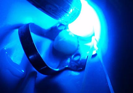 Rehabilitaciones Estéticas en Resinas 2026 1A