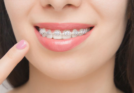 Ortodoncia Nivel Avanzado 2026 2A